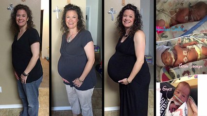 Family With Triplets Chronicles Journey Through Pregnancy