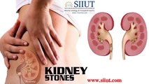Kidney Stone Specialist in Chennai - Best Urologist In India