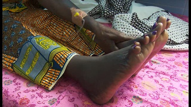 Santé: Journée mondiale des rhumatismes, près de 1000 personnes touchés par la maladie