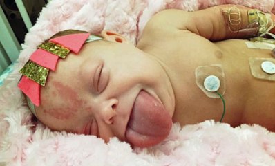 Dilinin Büyüklüğü Yüzünden Az Kalsın Boğuluyordu