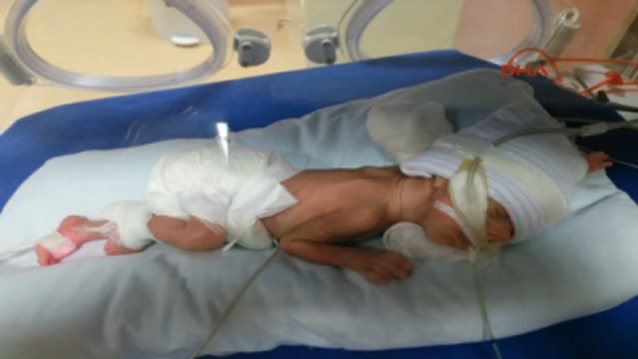 Kocaeli Özlem 10 Ayda 850 Gramdan 8 Kilo 700 Grama Ulaştı