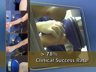 Extra Corporeal Shock Wave Treatment For Plantar Fasciitis