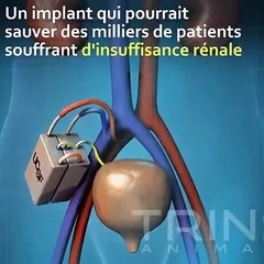 Rene artificiale: dal 2020 potrebbe diventare realtà