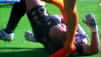 Edin Dzeko Hits Pepe Reina In The Head!