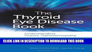 [EBOOK] DOWNLOAD The Thyroid Eye Disease Book: Understanding Graves  Ophthalmopathy PDF