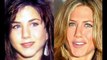 Top 19 Celebrities Before And After Plastic Surgery