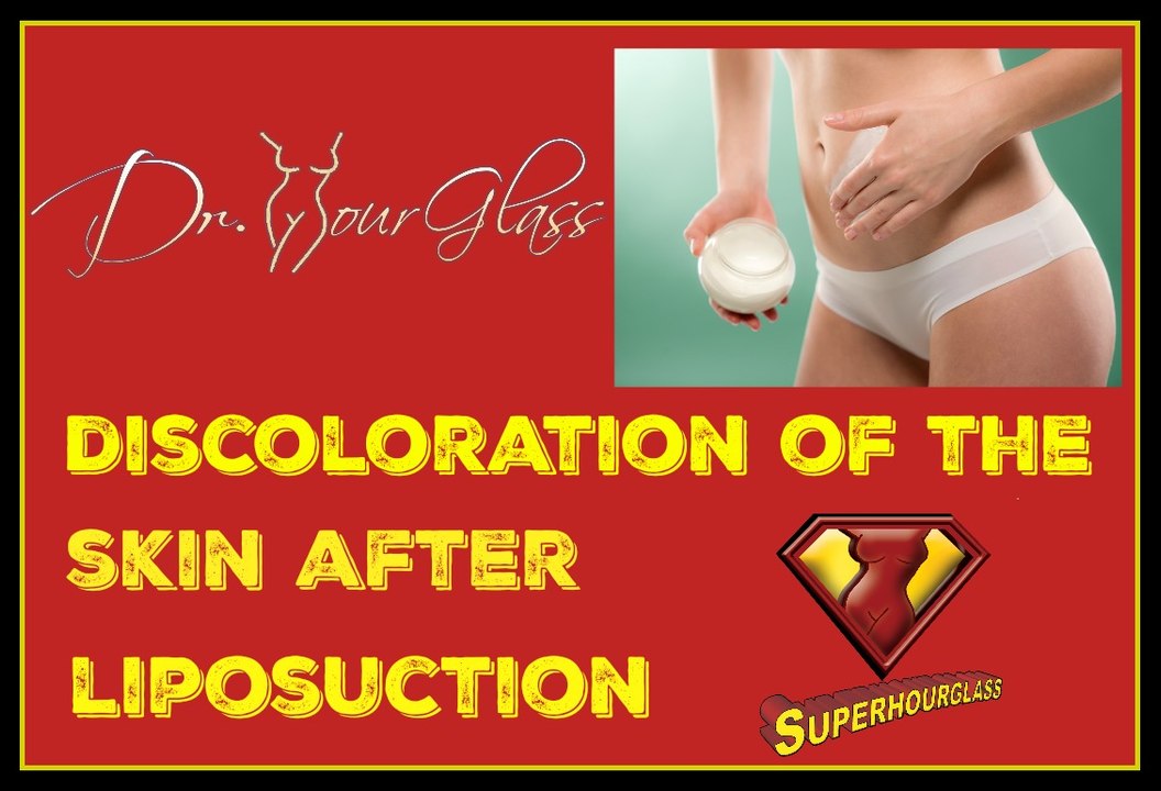 Liposuction complications