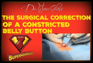 Tummy tuck constricted belly button