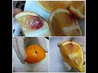 Algeria Found Hiv & AIDS Positive Oranges