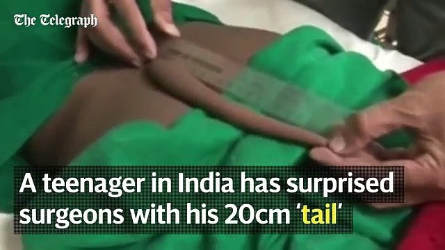 Un ados avec une queue dans le dos, non vous ne revez pas!