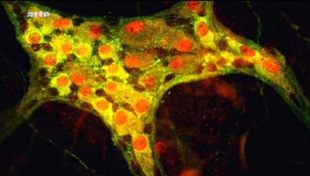 Mon ventre communique avec mon cerveau et mon comportement dépend des bactéries que j'ai dans le ventre