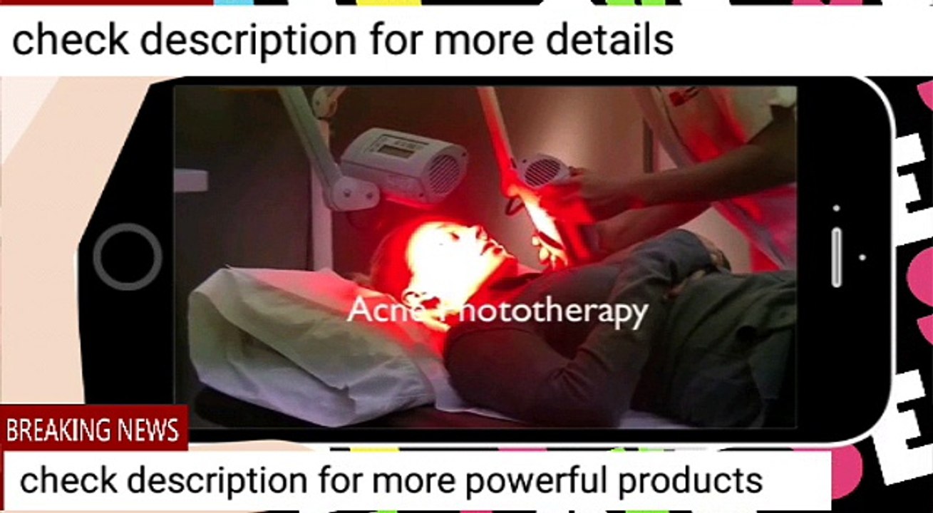 Acne treatment | revitol acne  removal cream | acne removal