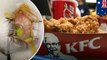 Remaja jadi buta karena hanya makan KFC & Coca cola selama 8 tahun - Tomonews