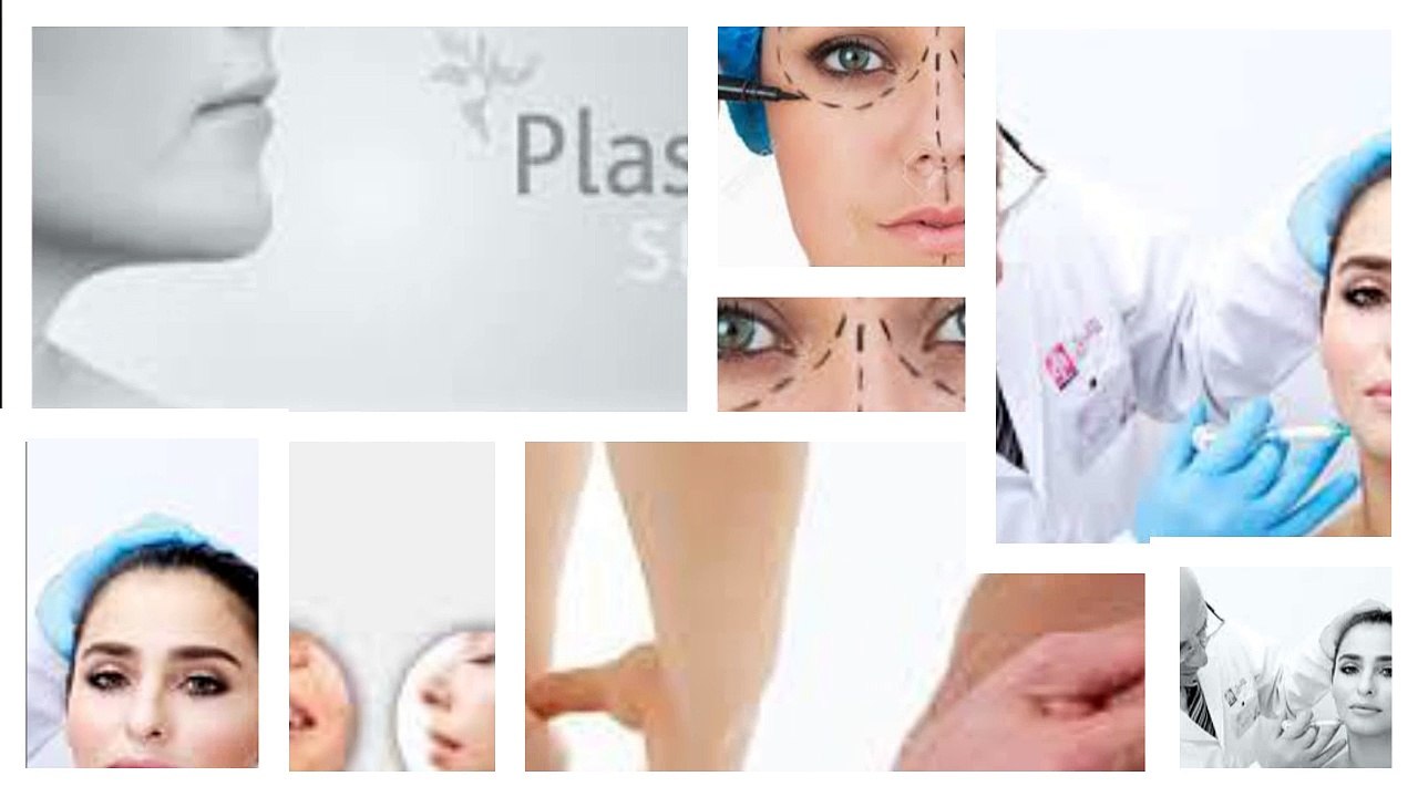 Plastic Surgery and Choosing a Plastic Surgeon