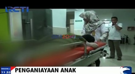Bocah Disiram Air Panas oleh Orangtua Angkatnya