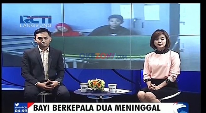 Bayi Kembar Siam Berkepala Dua Meninggal