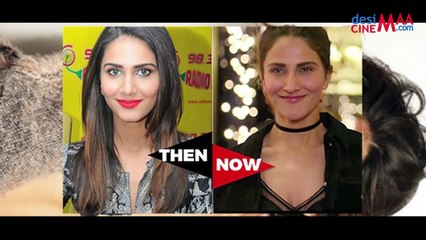 PLASTIC SURGERY GONE WRONG FOR THIS ACTRESS