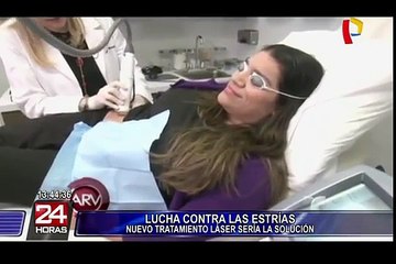 Nuevo tratamiento láser contra las estrías