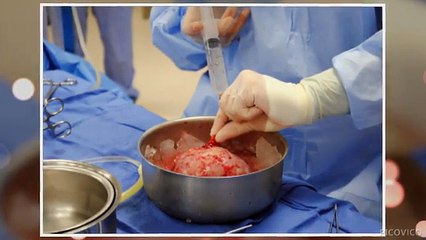 Kidney Transplant Doctors India