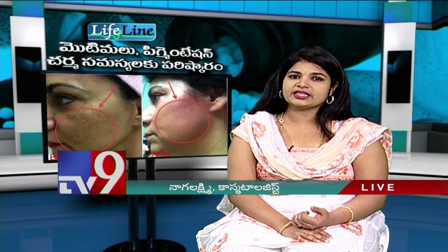 Pearl Fairness Cream - Pimples, Pigmentation and Scars treatment - Lifeline - TV9