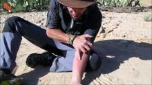 Il se laisse piquer par la bestiole à la deuxième piqûre la plus douloureuse au monde