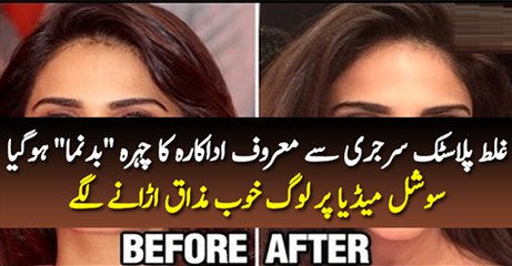 Actress Trolled on Social Media By Fans After Lip Surgery