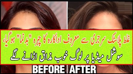 Actress Trolled on Social Media By Fans After Lip Surgery