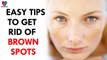 Easy Tips To Get Rid Of Brown Spots- Health Sutra