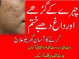 Chehre Ke Gadde Aur Daag Dhabe Door Karne Ka Asan Gharelu Ilaj  Removing Acne Scars
