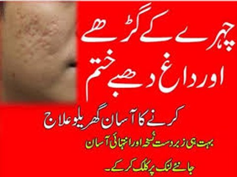 Chehre Ke Gadde Aur Daag Dhabe Door Karne Ka Asan Gharelu Ilaj Removing Acne Scars