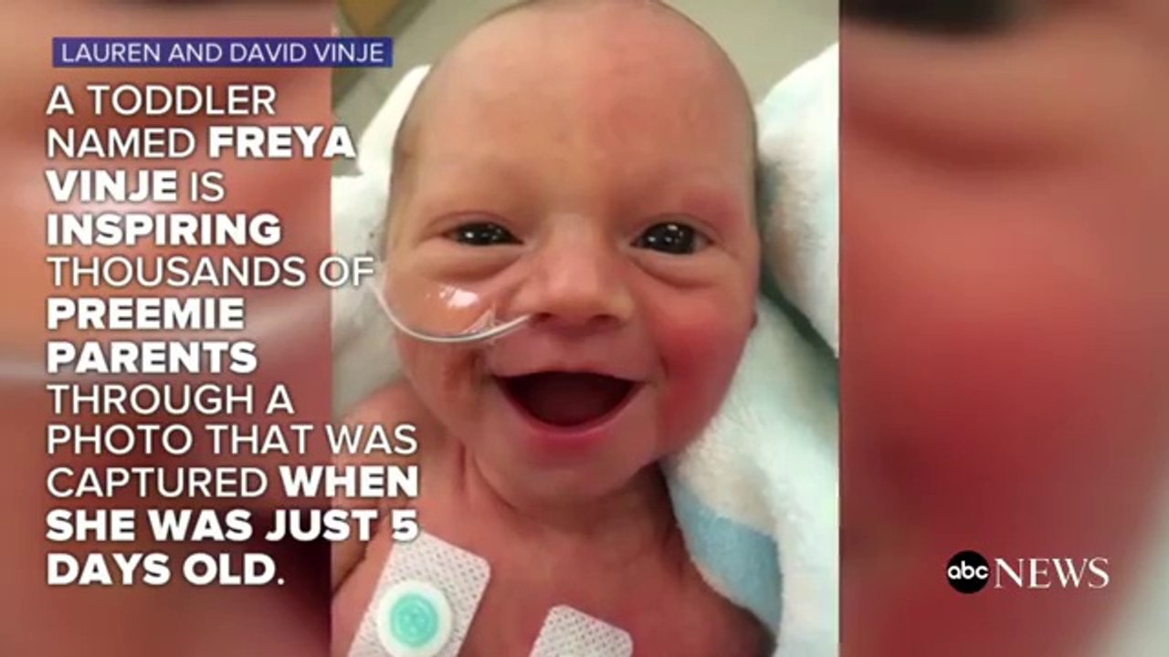 Regardez le sourire de ce bébé prématuré! Trop tot sorti et pourtant si heureux