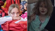 Tmerri i luftës civile siriane, në fytyrat e fëmijëve - Top Channel Albania - News - Lajme