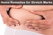 How to Get Rid of Stretch Marks