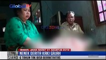 Enam Tahun Nenek Ini Derita Kaki Gajah