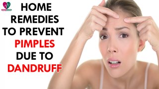 Home Remedies To Prevent Pimples Due To Dandruff- health Sutra