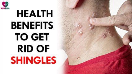 Home Remedies To Get Rid Of Shingles- health Sutra