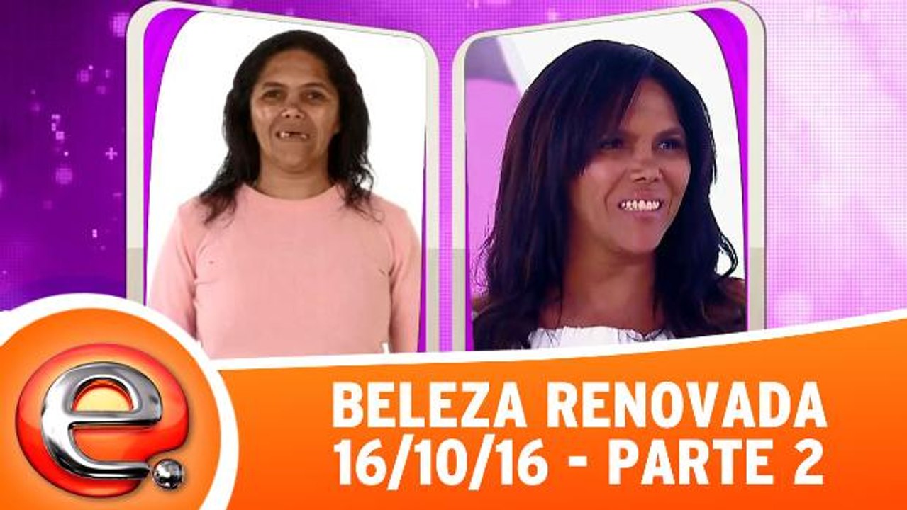 Beleza Renovada - 16.10.16 - Parte 2