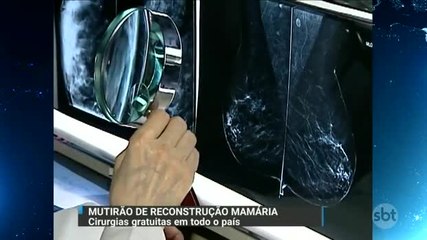 Médicos fazem mutirão para reconstruir mamas de mulheres vítimas do câncer