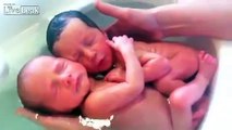 Twins were born, but haven't realized that.....