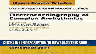 Read Now Electrocardiography of Complex Arrhythmias, An Issue of Cardiac Electrophysiology