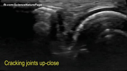 Le corps humain vu  grâce à l'IRM