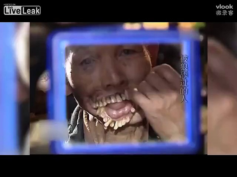 man gets terrible face afterbitten by wolf