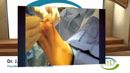 Help Your Diabetes: Tips on How to Avoid Amputation