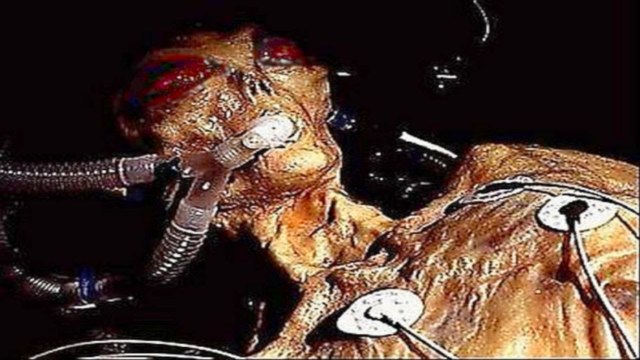 CASO ET DE VARGINHA O MAIOR E ASSUSTADOR CASO UFOLÓGICO DO BRASIL