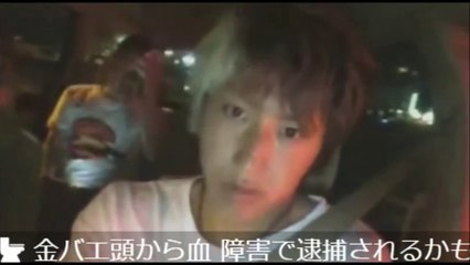 （6/7）【北海道3人旅】（5日目）金バエが頭から流血！病院に行く【しんやっちょ・SATOMI】