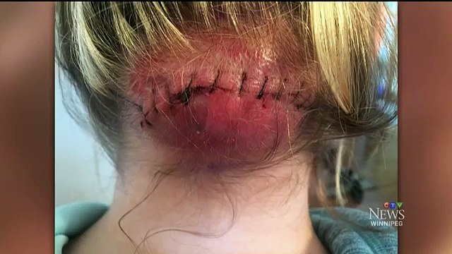 Tous les médecins lui disaient qu'elle n'avait rien de grave. Mais plusieurs mois plus tard, sa vie a basculé...