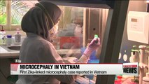First Zika-linked microcephaly case reported in Vietnam