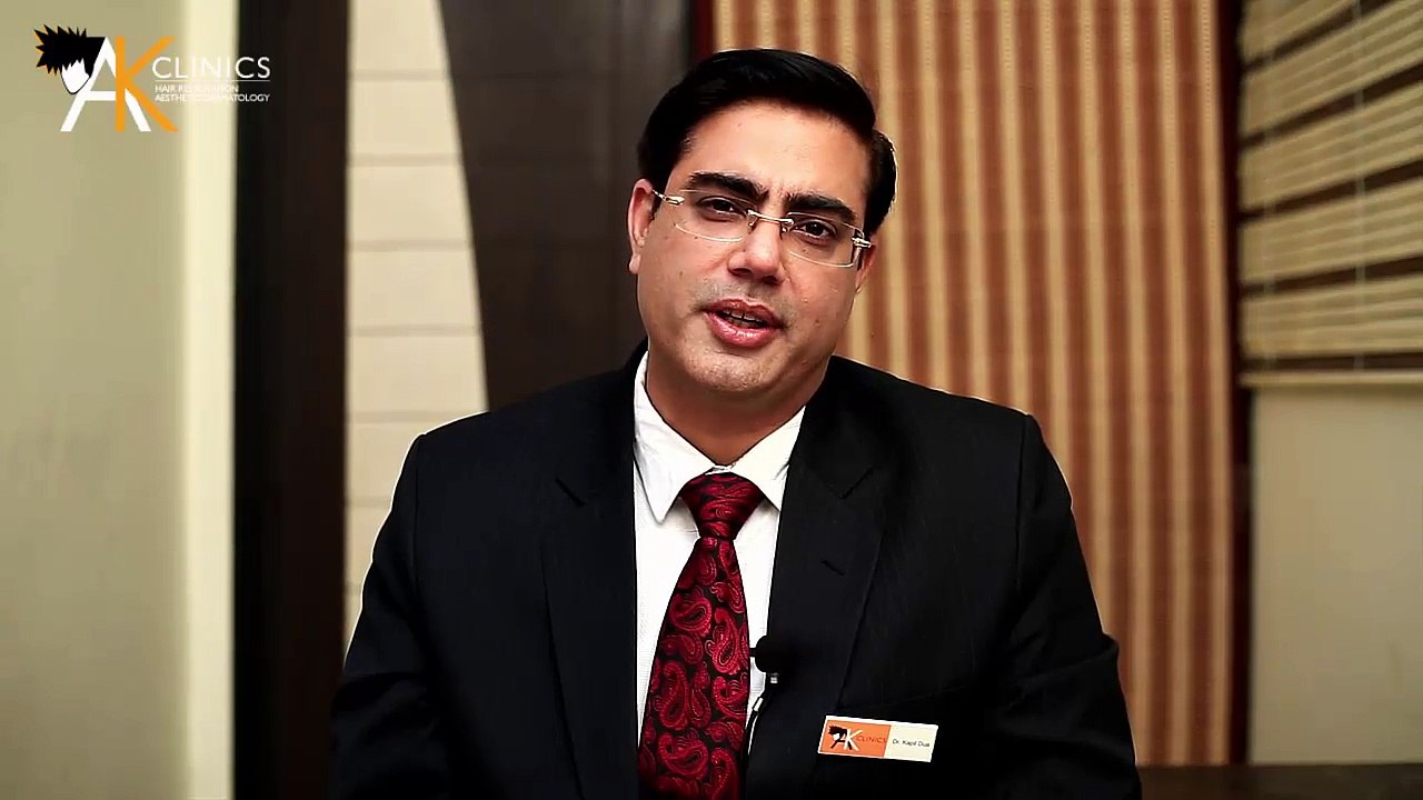 What is FUE (Follicle Unit Extraction) Hair Transplant Surgery : AKClinics