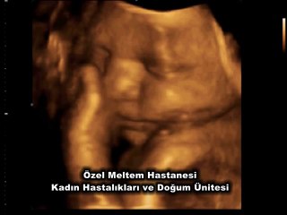 Özel Meltem Hastanesi | 4 Boyutlu Ultrason