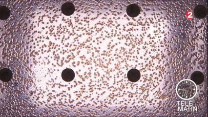 Santé - Antibiotiques : alerte aux résistances